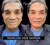 Harmonização facial de Dedé Santana viralizou no Instagram