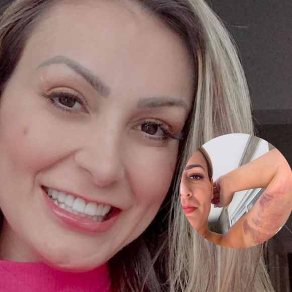 Andressa Urach mostrou o resultado das cirurgias plásticas que fez recentemente
