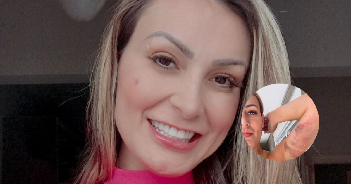 Andressa Urach mostrou o resultado das cirurgias plásticas que fez(01)
