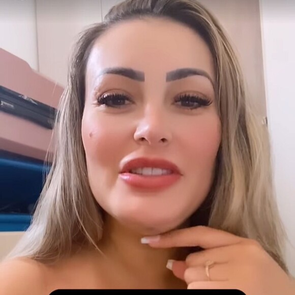 Andressa Urach também fez redução de papada