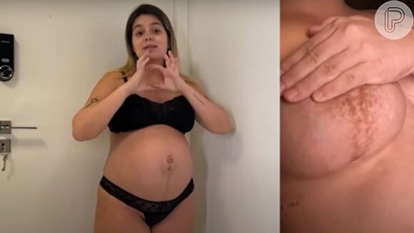 Viih Tube exibe manchas escuras em algumas partes do corpo