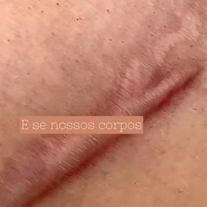 Cicatrizes no corpo também foram comparadas a elementos da natureza no vídeo postado por Paolla Oliveira