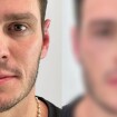 Ex de Key Alves, Gustavo Cowboy faz harmonização facial 1 mês depois da atleta. Veja antes e depois!