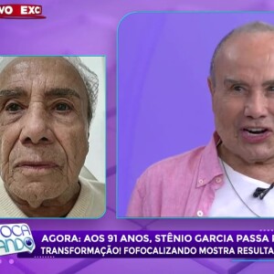 Stenio Garcia passou por uma harmonização facial recentemente