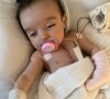 Filha de Thaila Ayala, Tereza precisou abrir o peito para uma cirurgia cardíaca aos 2 meses de vida