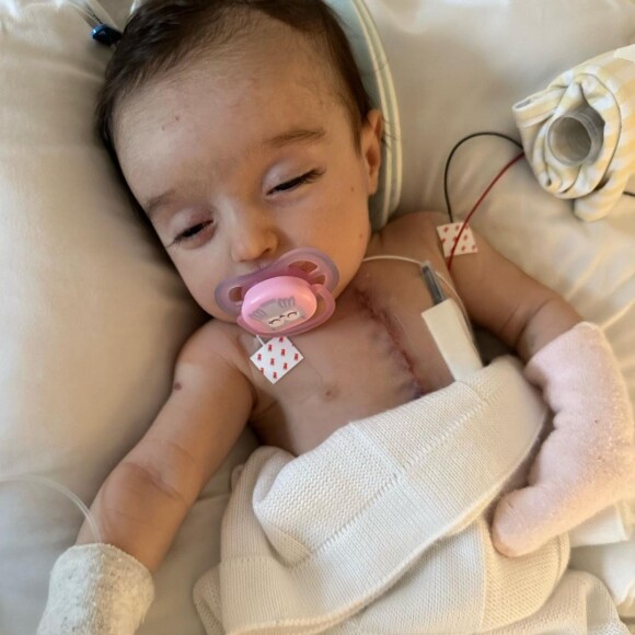 Filha de Thaila Ayala, Tereza precisou abrir o peito para uma cirurgia cardíaca aos 2 meses de vida