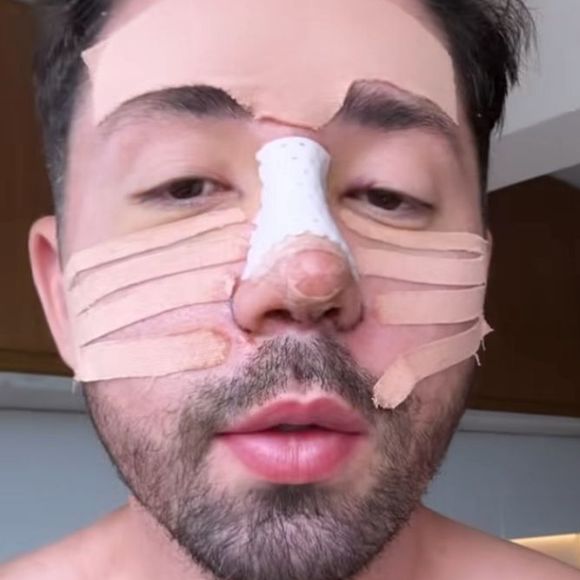 Rico Melquiades continua sendo criticado por causa de aparência nas redes sociais