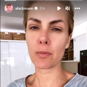 Ana Hickmann deu pista de que pedirá o divórcio para Alexandre Correa depois de agressão