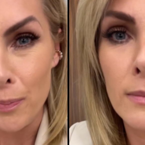 Ana Hickmann afirmou que ainda há mais podre para se saber sobre sua parceria com Alexandre Correa