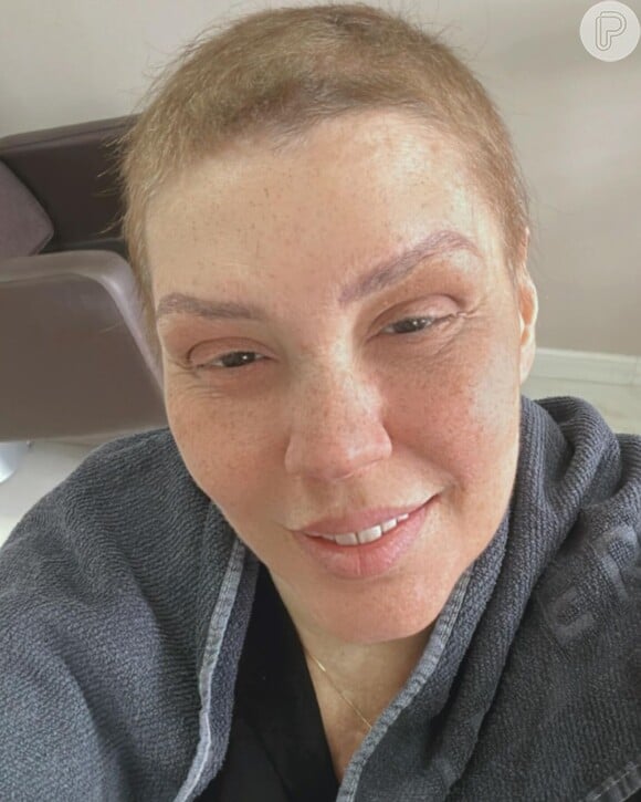 Simony foi diagnosticada com câncer no intestino em 2022 e retomou tratamento de imunoterapia no fim de 2023