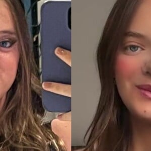 Rafaella Justus antes e depois da rinoplastia: cirurgia completou 1 mês no último dia 10