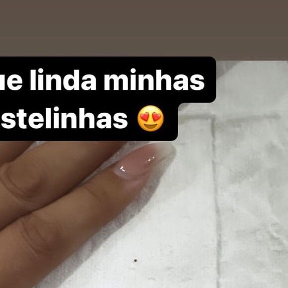 Andressa Urach ainda mostrou, neste sábado (16), suas costelas