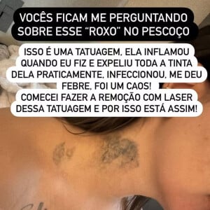 MC Mirella revela que tatuagem no pescoço infeccionou