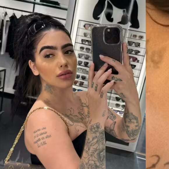 Chupão? Roxo no pescoço de MC Mirella chama atenção e verdadeiro motivo vem à tona: mancha é uma infecção!