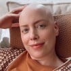 'Alguns cacheados, outros lisos': após transplante de medula, Fabiana Justus revela mudança na cor e curvatura do cabelo