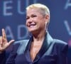 Xuxa passa por 80 procedimentos estéticos em apenas 7 horas em tratamento inovador