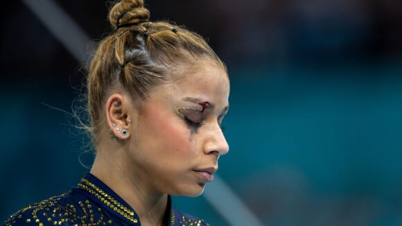 Como ficou o rosto de Flávia Saraiva após queda nas Olimpíadas? Ginasta mostra cicatriz na sobrancelha e surpreende: 'Pela medalha...'