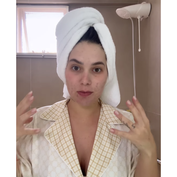 Nesta terça-feira (10), Virgínia Fonseca mostrou sua pele nas redes sociais e disse ter aumentado as manchas de acne