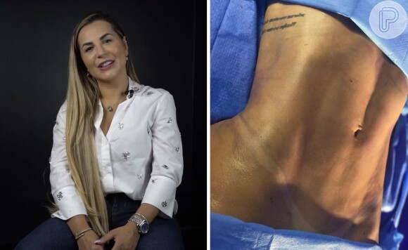 Já no corpo, Deolane Bezerra realizou uma lipo LAD e ainda fez mamoplastia
