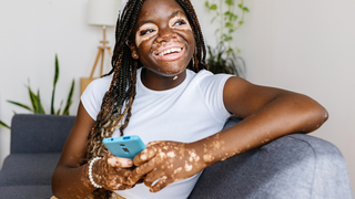 Saiba quais são os cuidados que uma pele com vitiligo precisa ter