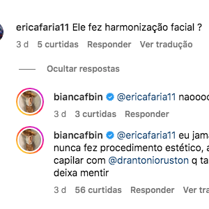 Bianca Bin negou que o marido tenha feito harmonização facial e disse que não permitiria procedimentos estéticos nele