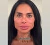 Kamila Simioni, após harmonização facial, compartilhou um vídeo em seu Instagram mostrando o resultado.