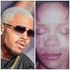 Em 2009, Chris Brown foi preso após agredir a namorada, Rihanna, que se preparava para se apresentar no Grammy. Primeiro, a cantora alegou que faltou à cerimônia devido a um acidente de carro. Depois, muito machucada, ela foi à polícia e denunciou a agressão