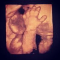 Juliana Paes publica foto do ultrassom de seu segundo filho, Antônio