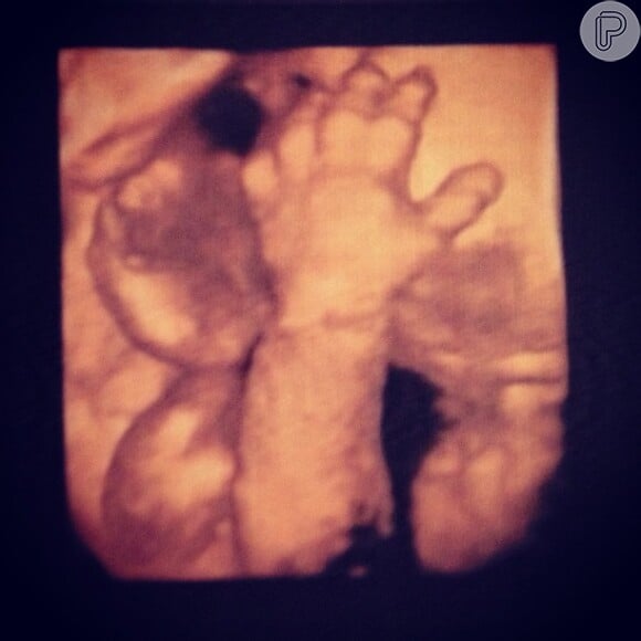 Juliana Paes publica imagem de ultrassom de Antônio, seu segundo filho, em 24 de abril de 2013