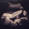 Grávida dos gêmeos Liz e Bem, Luana Piovani mostrou o ultrassom da menina no Instagram nesta segunda-feira, 15 de junho de 2015: 'Tem alguém fazendo alongamento dentro da minha barriga', brincou a atriz na legenda