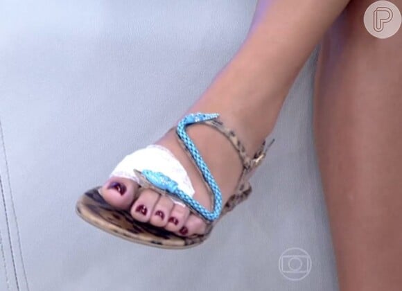 Fernanda mostrou o curativo no pé machucado no programa de Fátima Bernardes