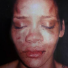 Rihanna foi espancada por seu namorado, Chris Brown, em fevereiro de 2009. O caso foi parar na manchete de jornais e sites especializados. Chris Brown foi condenado 5 anos de liberdade condicional e 180 dias de trabalho comunitário