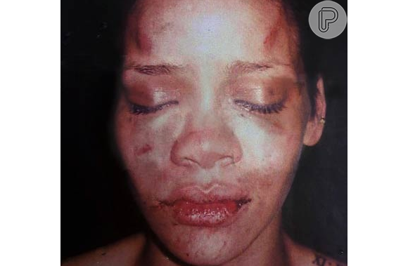 Rihanna foi espancada por seu namorado, Chris Brown, em fevereiro de 2009. O caso foi parar na manchete de jornais e sites especializados. Chris Brown foi condenado 5 anos de liberdade condicional e 180 dias de trabalho comunitário