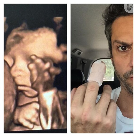 Alexandre Nero postou no Instagram uma montagem com a ultrassonografia do filho, Noá, com os dois dando o 'dedo do meio'