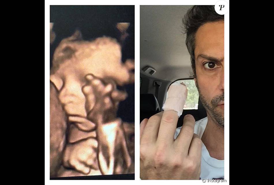 Alexandre Nero Postou No Instagram Uma Montagem Com A Ultrassonografia Do Filho Noa Com Os Dois Dando O Dedo Do Meio Purepeople