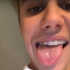Fãs acham que dente de ouro de Justin Bieber é removível e para a 'novidade' anunciada pelo cantor