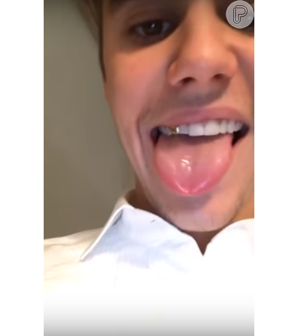 Fãs acham que dente de ouro de Justin Bieber é removível e para a 'novidade' anunciada pelo cantor