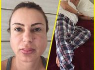 Mulher de Stênio Garcia mostra imagem do casal com caxumba: 'Dor é insuportável'