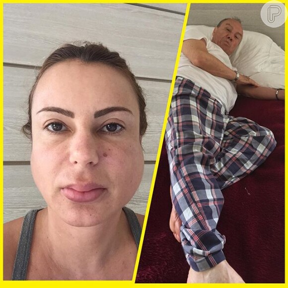 Mulher de Stênio Garcia postou uma foto na qual aparece com caxumba e também mostra o marido debilitado