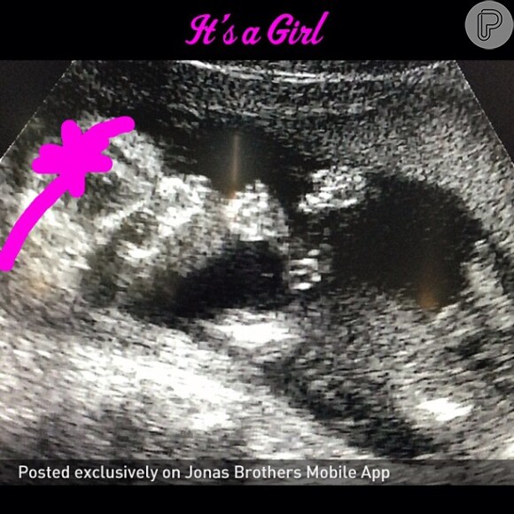 'Ela está chupando o dedão!', escreveu Kevin Jonas na legenda da foto do ultrassom que mostrou o sexo do bebê
