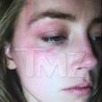 A atriz alega que o artista atirou o celular em seu rosto. A imagem divulgada pela atriz mostra um ferimento abaixo do seu olho direito