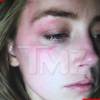 Amber Heard mostrou seu rosto machucado para o site americano 'TMZ'