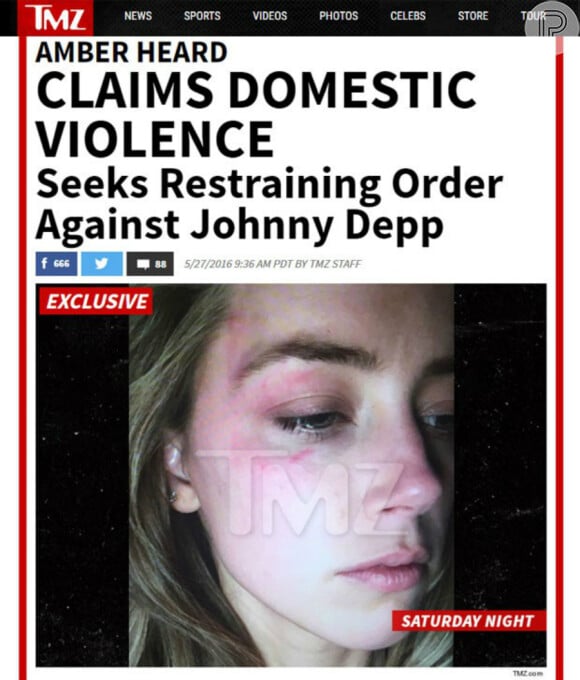 Amber Heard mostrou seu rosto machucado para o site americano 'TMZ'