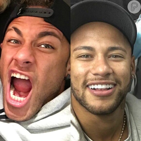 Neymar muda sorriso e adota lente de contato nos dentes nesta sexta-feira, dia 24 de junho de 2016