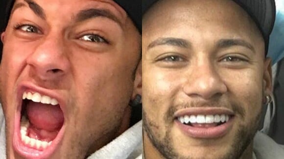 Neymar muda sorriso e adota lente de contato nos dentes: 'Microscopia'. Compare!
