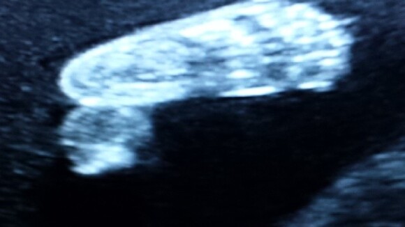 Ana Hickmann, grávida, faz ultrassonografia e marido vibra: 'Alegria sem fim'