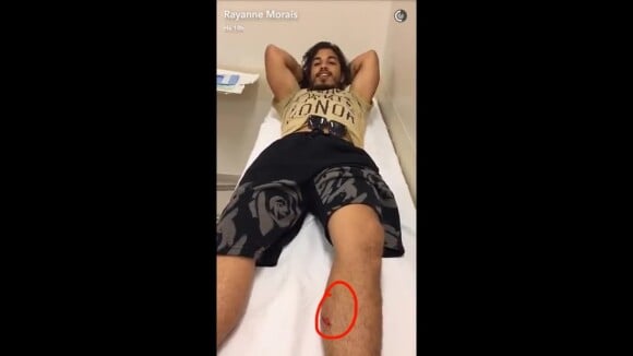 Douglas Sampaio corta a perna em bicicleta e leva seis pontos: 'Nervoso'. Vídeo!