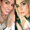 Ex-BBB Adriana Sant'Anna mostra nariz após 14 dias de rinoplastia em seu perfil do Instagram, na noite desta quinta-feira, 23 de fevereiro de 2017