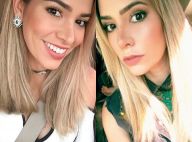 Ex-BBB Adriana Sant'Anna mostra nariz 14 dias após rinoplastia: 'Sutil'