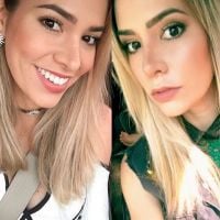 Ex-BBB Adriana Sant'Anna mostra nariz 14 dias após rinoplastia: 'Sutil'